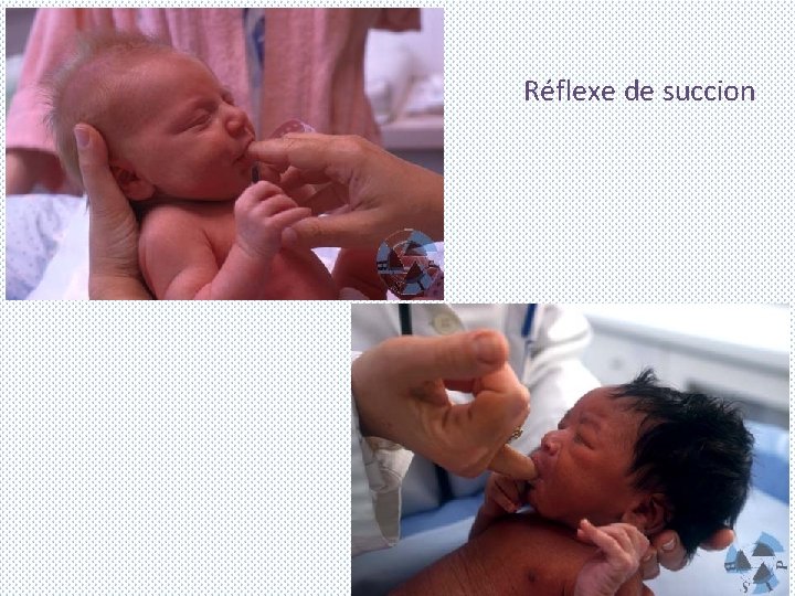 Réflexe de succion 