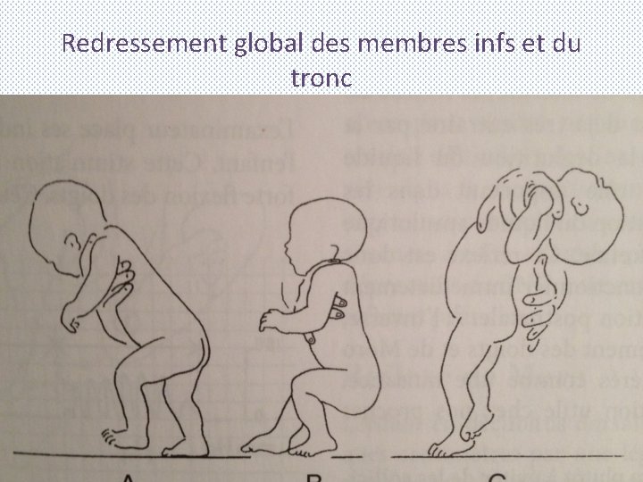 Redressement global des membres infs et du tronc 