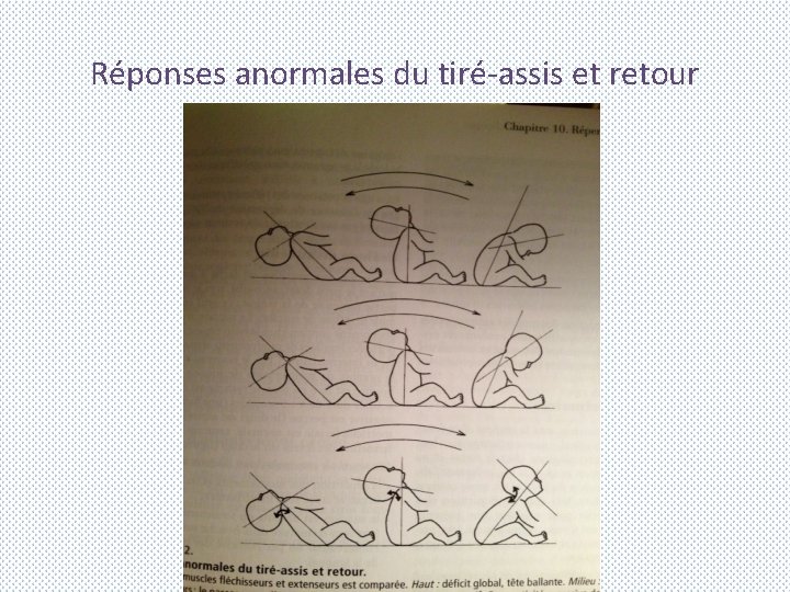Réponses anormales du tiré-assis et retour 
