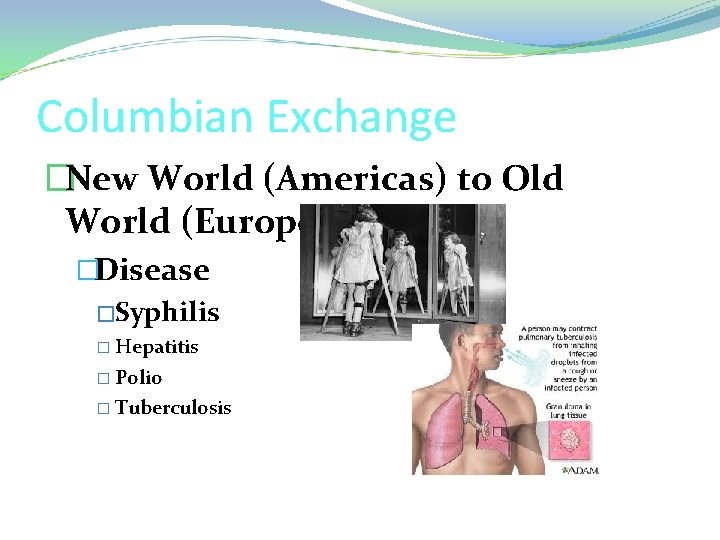 Columbian Exchange �New World (Americas) to Old World (Europe) �Disease �Syphilis � Hepatitis �