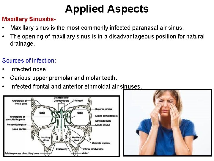 Applied Aspects Maxillary Sinusitis • Maxillary sinus is the most commonly infected paranasal air