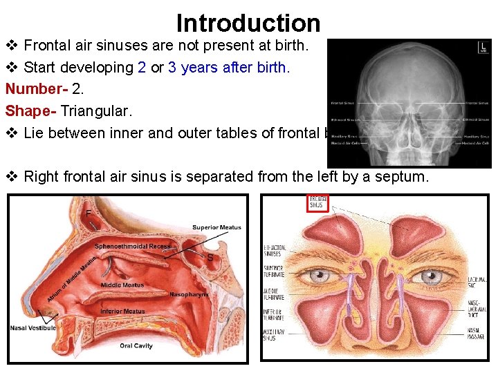 Introduction v Frontal air sinuses are not present at birth. v Start developing 2