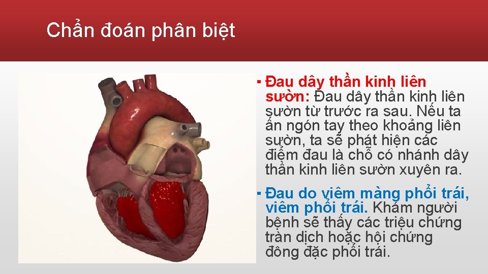 Chẩn đoán phân biệt ▪ Đau dây thần kinh liên sườn: Đau dây thần