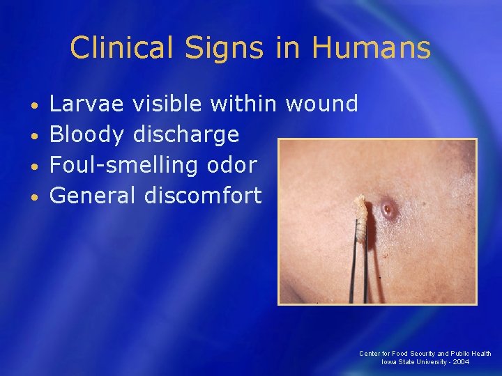 Clinical Signs in Humans Larvae visible within wound • Bloody discharge • Foul-smelling odor