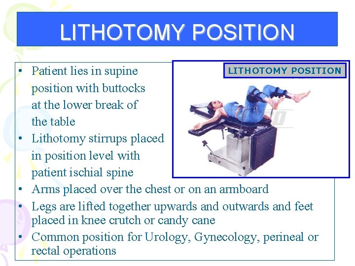 LITHOTOMY POSITION • Patient lies in supine position with buttocks at the lower break