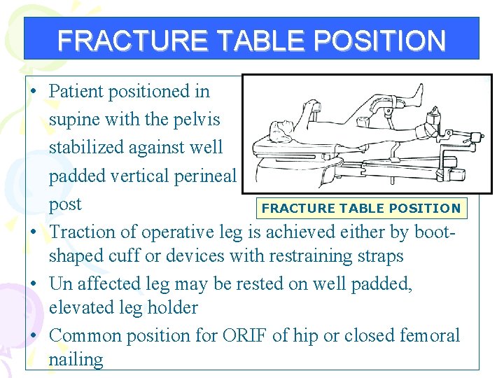 FRACTURE TABLE POSITION • Patient positioned in supine with the pelvis stabilized against well