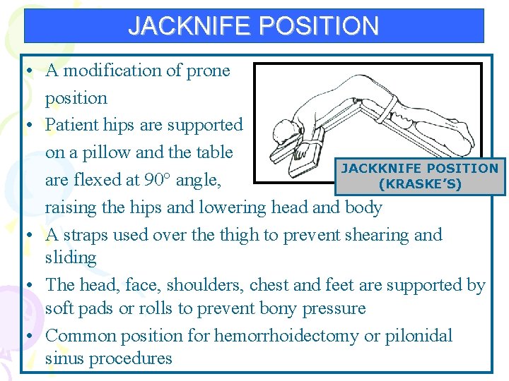JACKNIFE POSITION • A modification of prone position • Patient hips are supported on