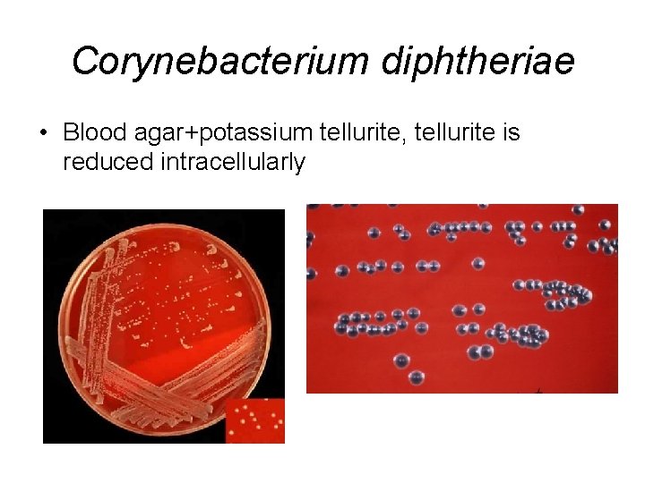 Corynebacterium diphtheriae • Blood agar+potassium tellurite, tellurite is reduced intracellularly 