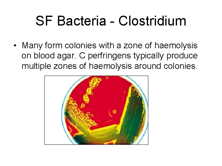 SF Bacteria - Clostridium • Many form colonies with a zone of haemolysis on