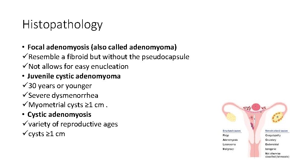Histopathology • Focal adenomyosis (also called adenomyoma) üResemble a fibroid but without the pseudocapsule