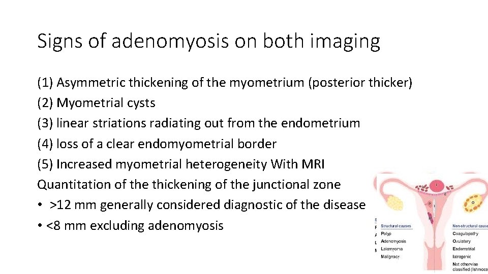 Signs of adenomyosis on both imaging (1) Asymmetric thickening of the myometrium (posterior thicker)
