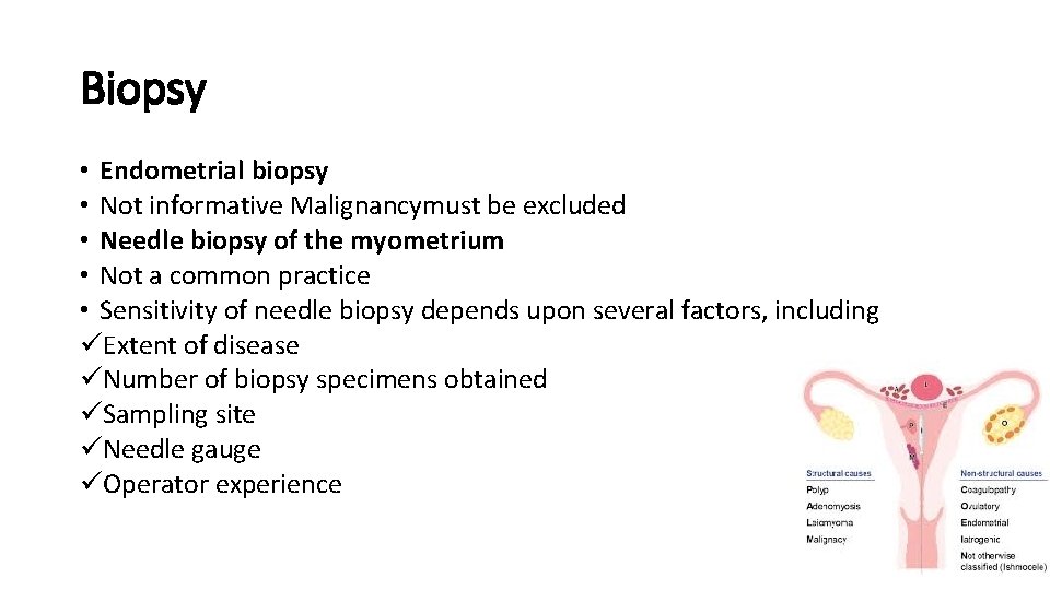 Biopsy • Endometrial biopsy • Not informative Malignancymust be excluded • Needle biopsy of