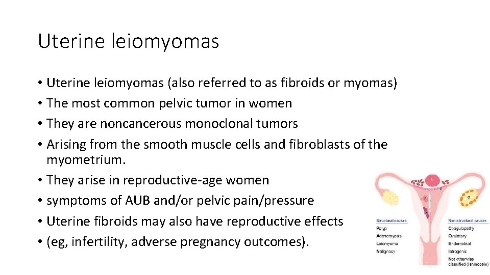 Uterine leiomyomas • Uterine leiomyomas (also referred to as fibroids or myomas) • The