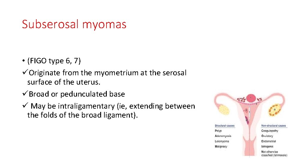 Subserosal myomas • (FIGO type 6, 7) üOriginate from the myometrium at the serosal