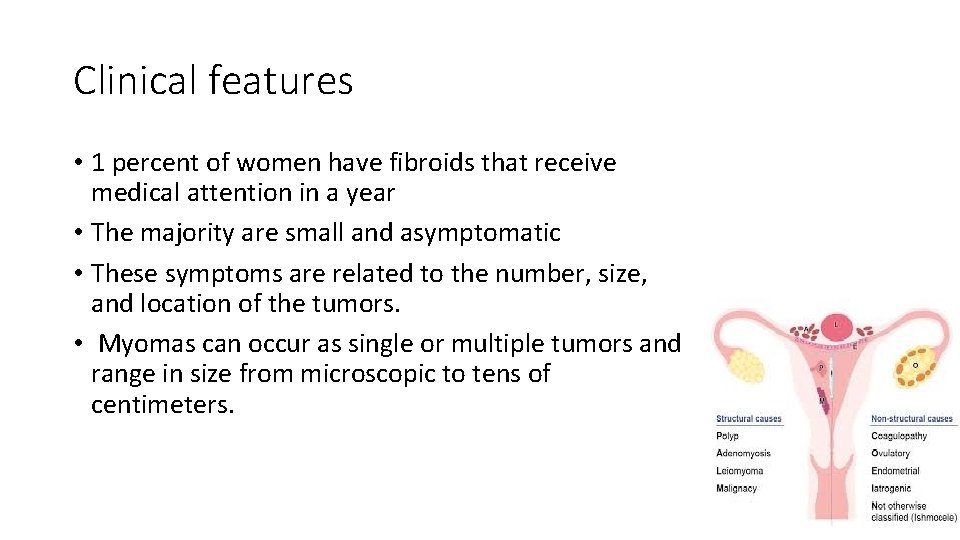 Clinical features • 1 percent of women have fibroids that receive medical attention in