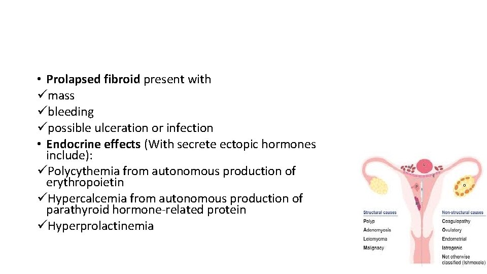 • Prolapsed fibroid present with ümass übleeding üpossible ulceration or infection • Endocrine