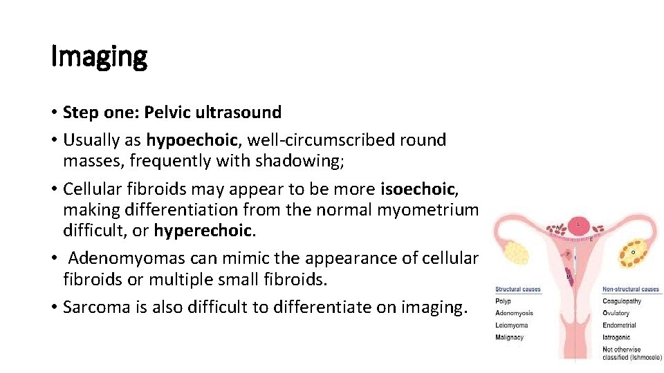 Imaging • Step one: Pelvic ultrasound • Usually as hypoechoic, well-circumscribed round masses, frequently