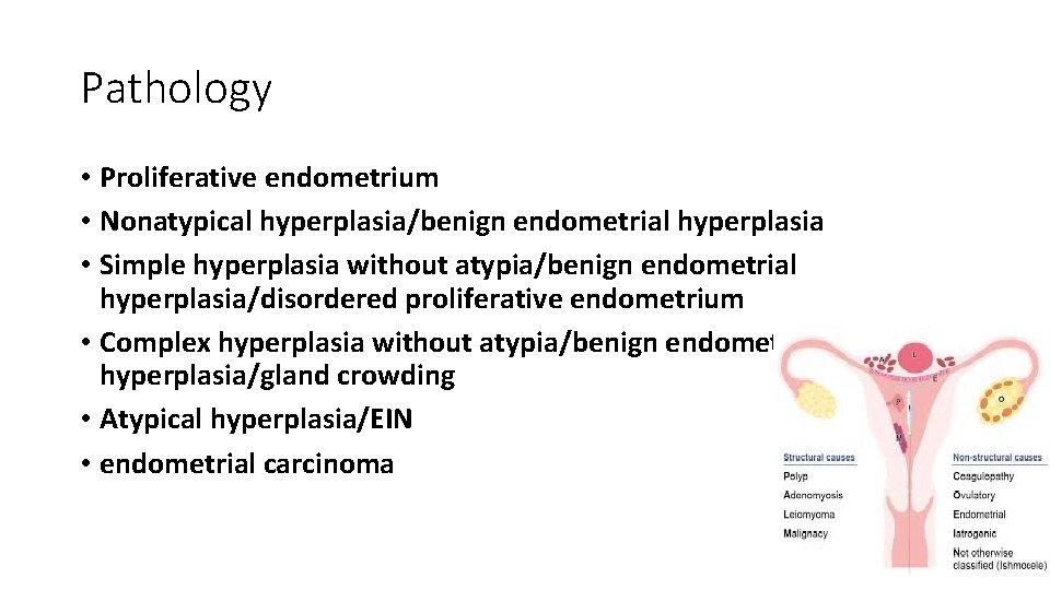 Pathology • Proliferative endometrium • Nonatypical hyperplasia/benign endometrial hyperplasia • Simple hyperplasia without atypia/benign
