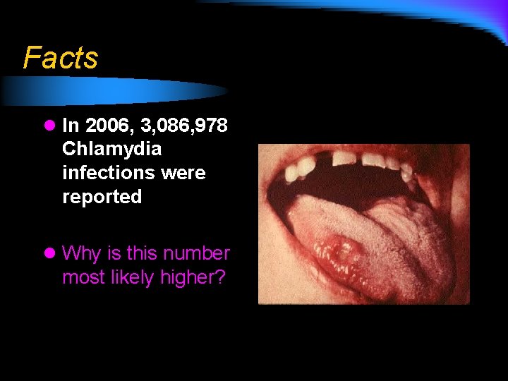 Facts l In 2006, 3, 086, 978 Chlamydia infections were reported l Why is