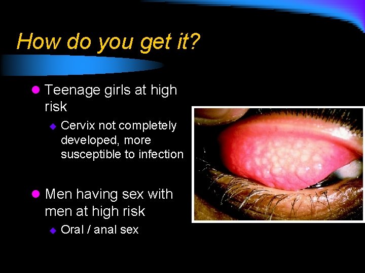 How do you get it? l Teenage girls at high risk u Cervix not