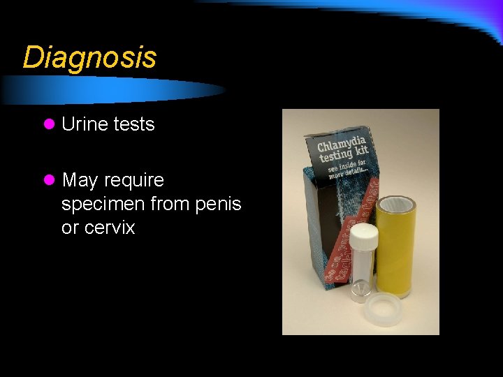 Diagnosis l Urine tests l May require specimen from penis or cervix 