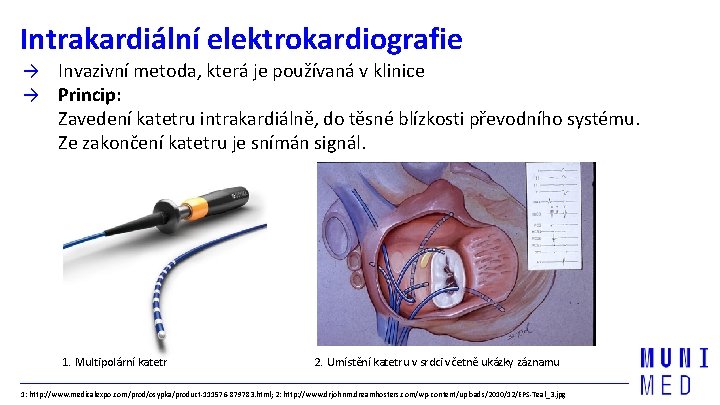 Intrakardiální elektrokardiografie → Invazivní metoda, která je používaná v klinice → Princip: Zavedení katetru