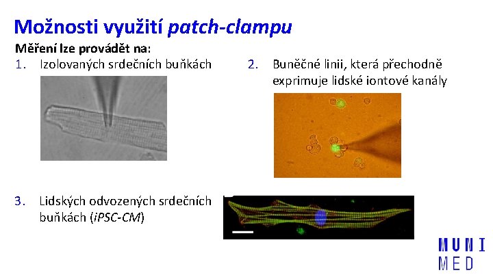 Možnosti využití patch-clampu Měření lze provádět na: 1. Izolovaných srdečních buňkách 3. Lidských odvozených
