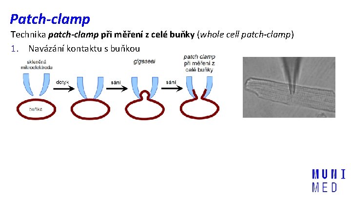 Patch-clamp Technika patch-clamp při měření z celé buňky (whole cell patch-clamp) 1. Navázání kontaktu