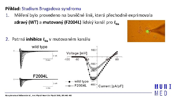 Příklad: Studium Brugadova syndromu 1. Měření bylo provedeno na buněčné linii, která přechodně exprimovala