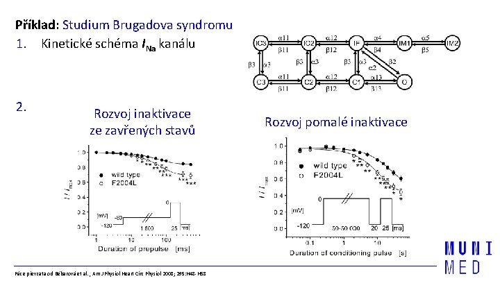 Příklad: Studium Brugadova syndromu 1. Kinetické schéma INa kanálu 2. d Rozvoj inaktivace ze