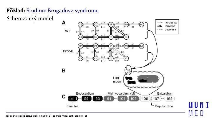 Příklad: Studium Brugadova syndromu Schematický model Páce převzata od Bébarová et al. , Am