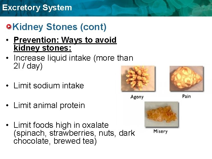 Excretory System Kidney Stones (cont) • Prevention: Ways to avoid kidney stones: • Increase Excretory System Kidney Stones (cont) • Prevention: Ways to avoid kidney stones: • Increase