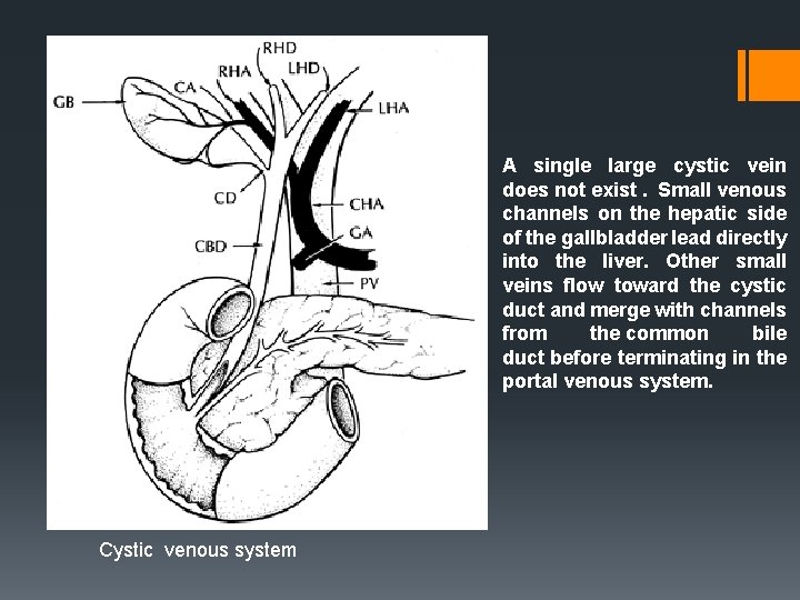 A single large cystic vein does not exist. Small venous channels on the hepatic
