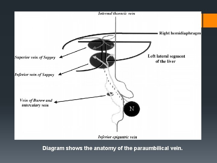 Diagram shows the anatomy of the paraumbilical vein. 