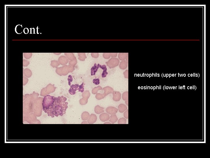 Cont. neutrophils (upper two cells) eosinophil (lower left cell) 