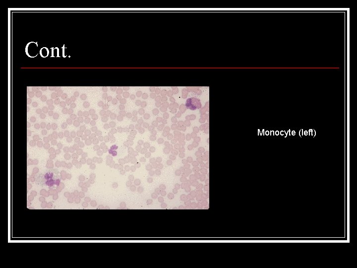 Cont. Monocyte (left) 