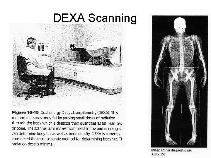 DEXA Scanning 21 