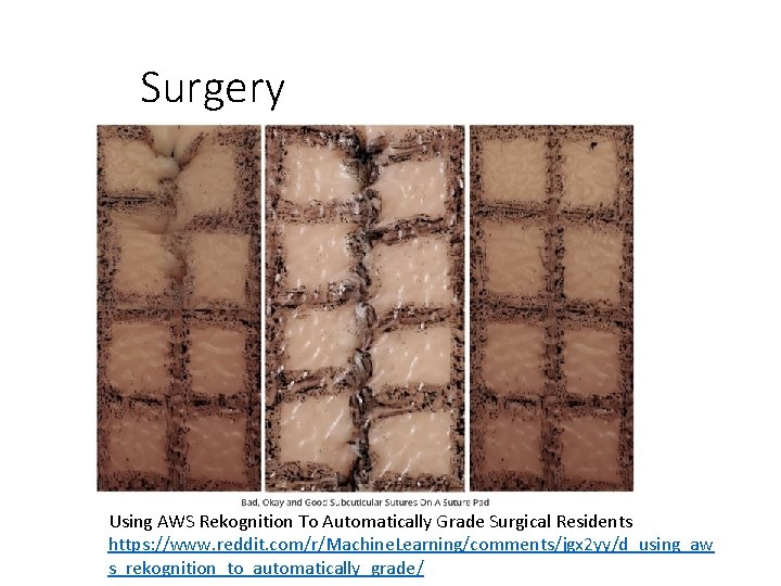 Surgery Using AWS Rekognition To Automatically Grade Surgical Residents https: //www. reddit. com/r/Machine. Learning/comments/jgx