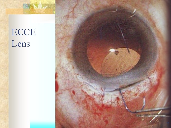 ECCE Lens 7 