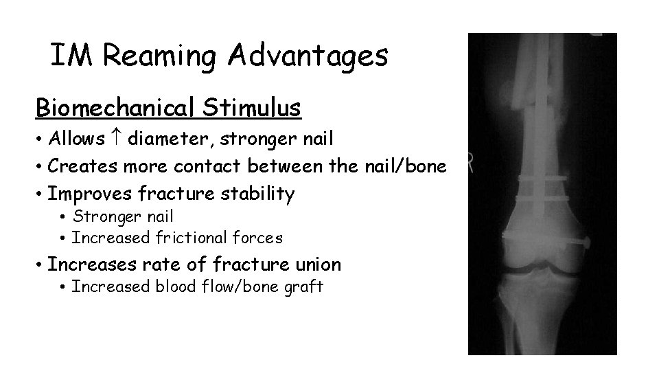 IM Reaming Advantages Biomechanical Stimulus • Allows diameter, stronger nail • Creates more contact