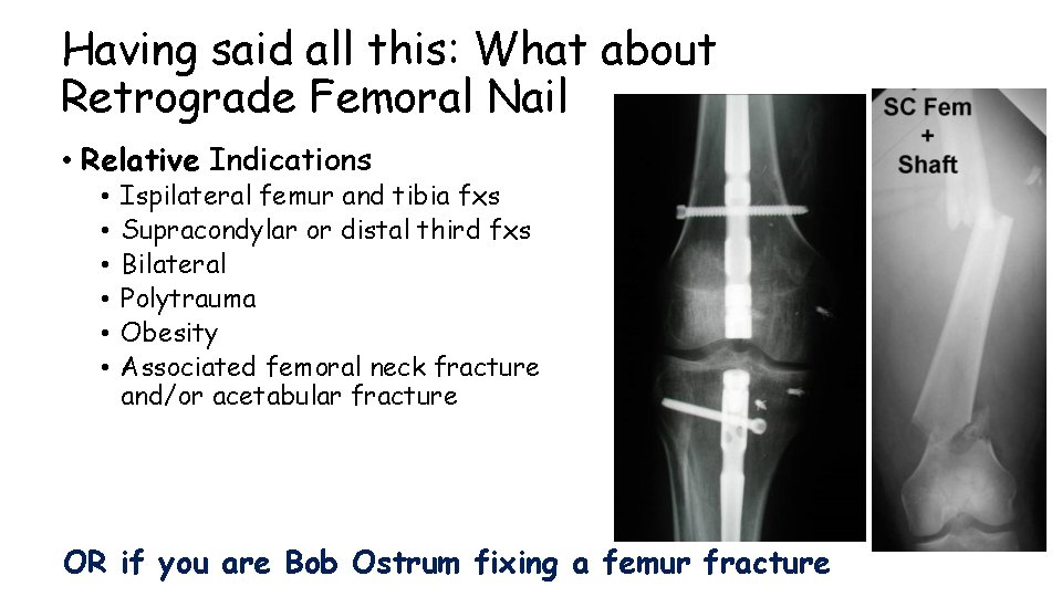 Having said all this: What about Retrograde Femoral Nail • Relative Indications • •
