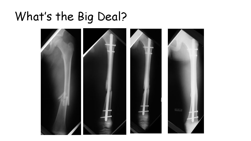 What’s the Big Deal? 