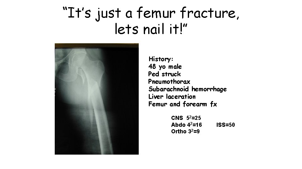 “It’s just a femur fracture, lets nail it!” History: 48 yo male Ped struck