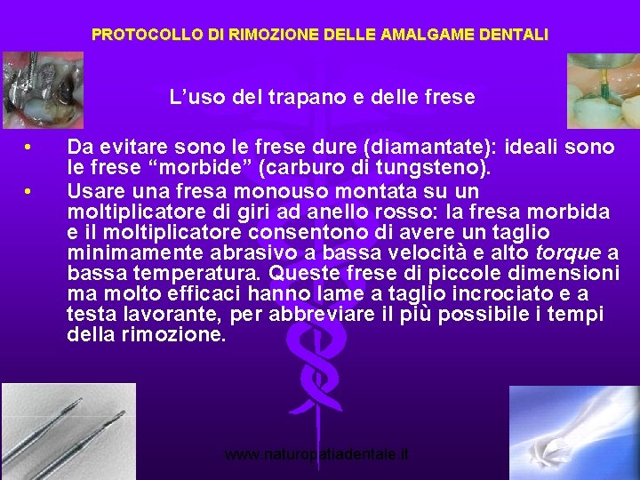 PROTOCOLLO DI RIMOZIONE DELLE AMALGAME DENTALI L’uso del trapano e delle frese • •