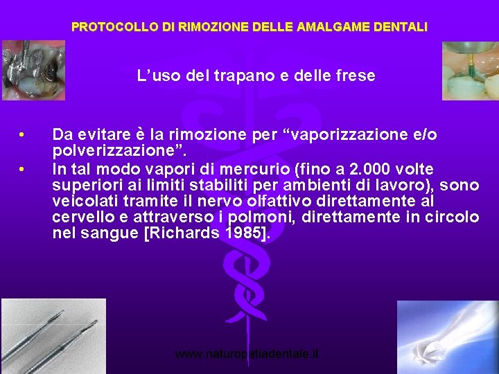 PROTOCOLLO DI RIMOZIONE DELLE AMALGAME DENTALI L’uso del trapano e delle frese • •