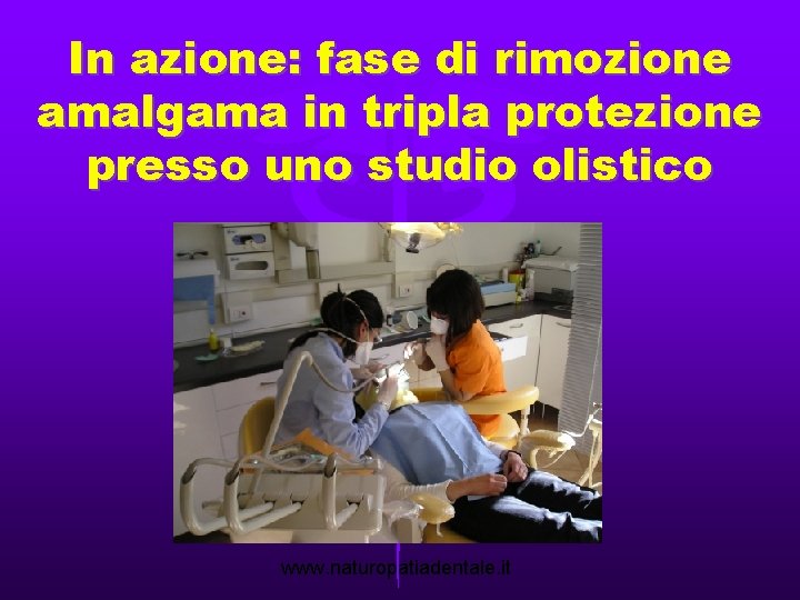 In azione: fase di rimozione amalgama in tripla protezione presso uno studio olistico www.