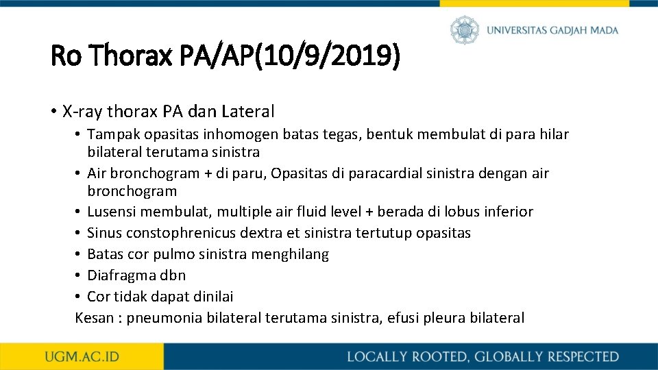 Ro Thorax PA/AP(10/9/2019) • X-ray thorax PA dan Lateral • Tampak opasitas inhomogen batas