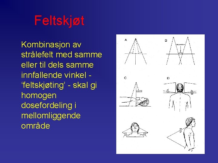 Feltskjøt Kombinasjon av strålefelt med samme eller til dels samme innfallende vinkel ‘feltskjøting’ -