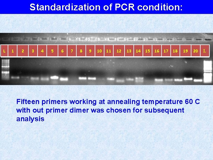 Standardization of PCR condition: L 1 2 3 4 5 6 7 8 9