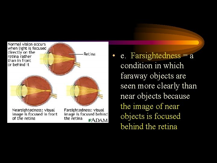  • e. Farsightedness = a condition in which faraway objects are seen more